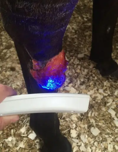 Blue light therapy is effective in destroying bacteria
